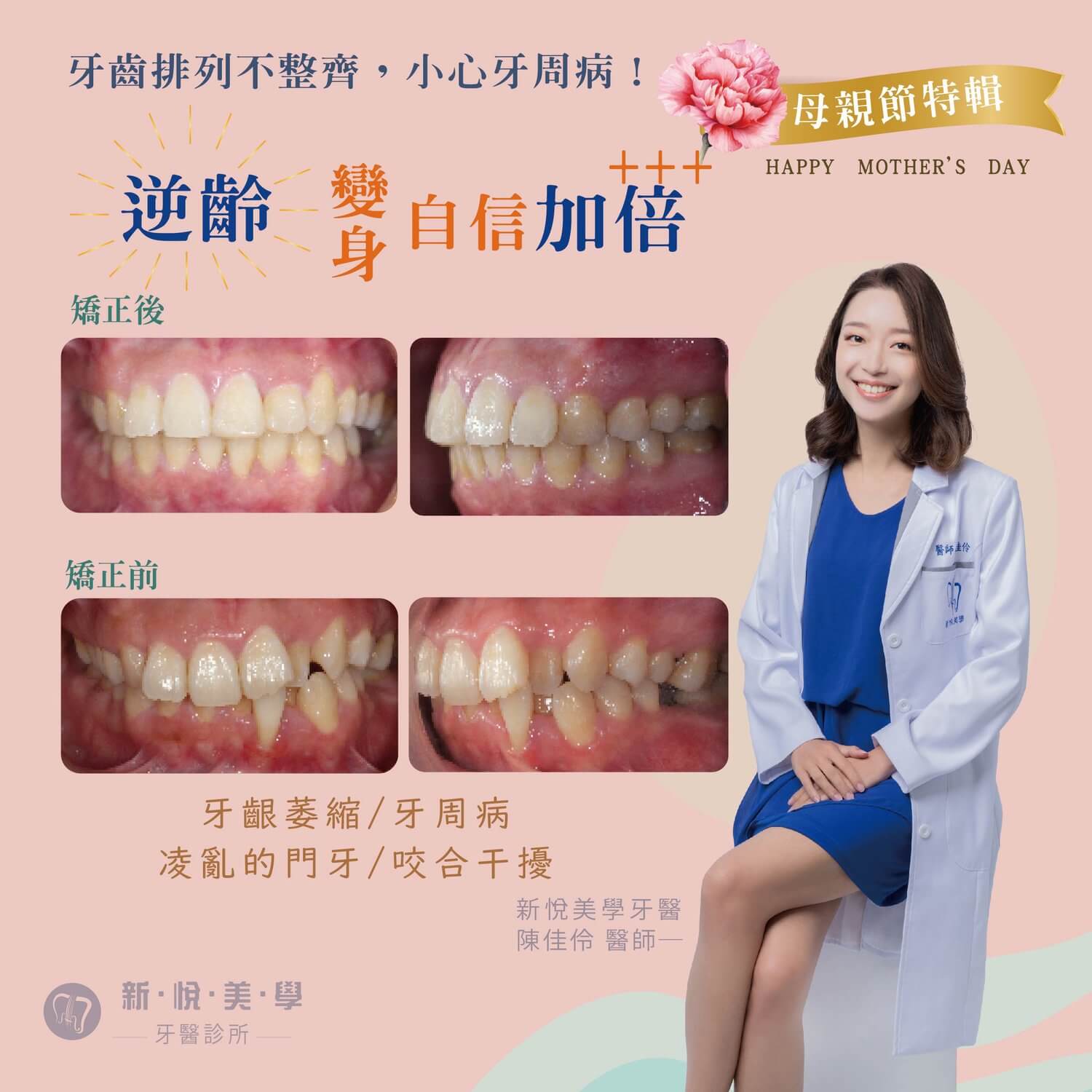 新悅美學牙醫診所的案例分享圖片